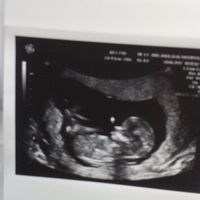 Semana 13