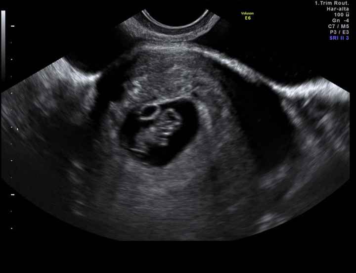 Futuras mamis Julio 2022! - 1