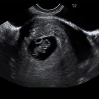Futuras mamis Julio 2022! - 1