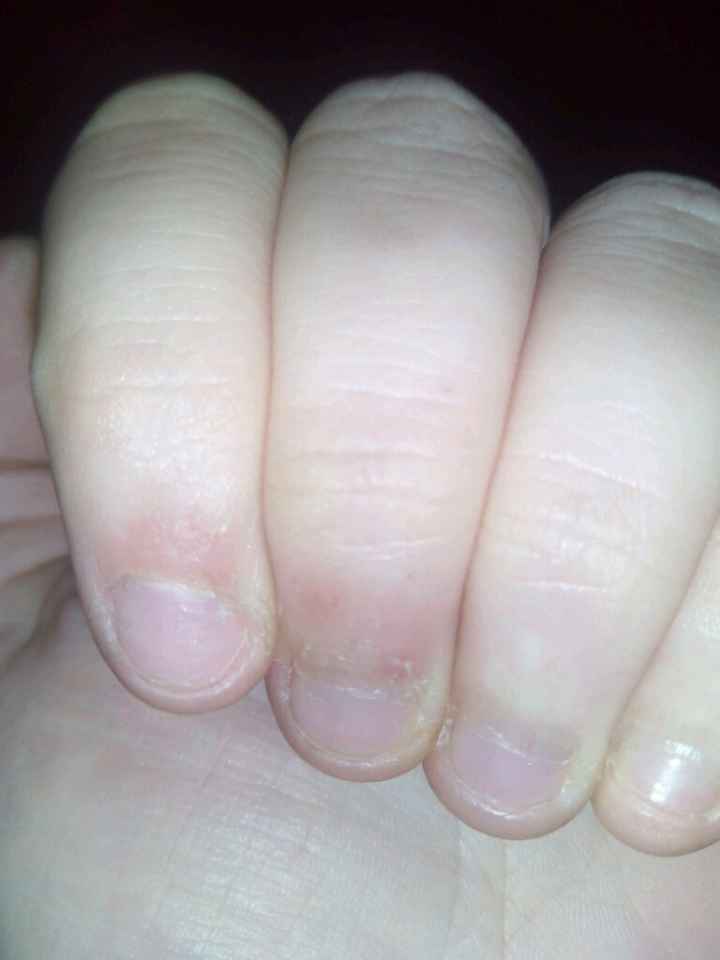 Y que hago yo con estas uñas? - 1