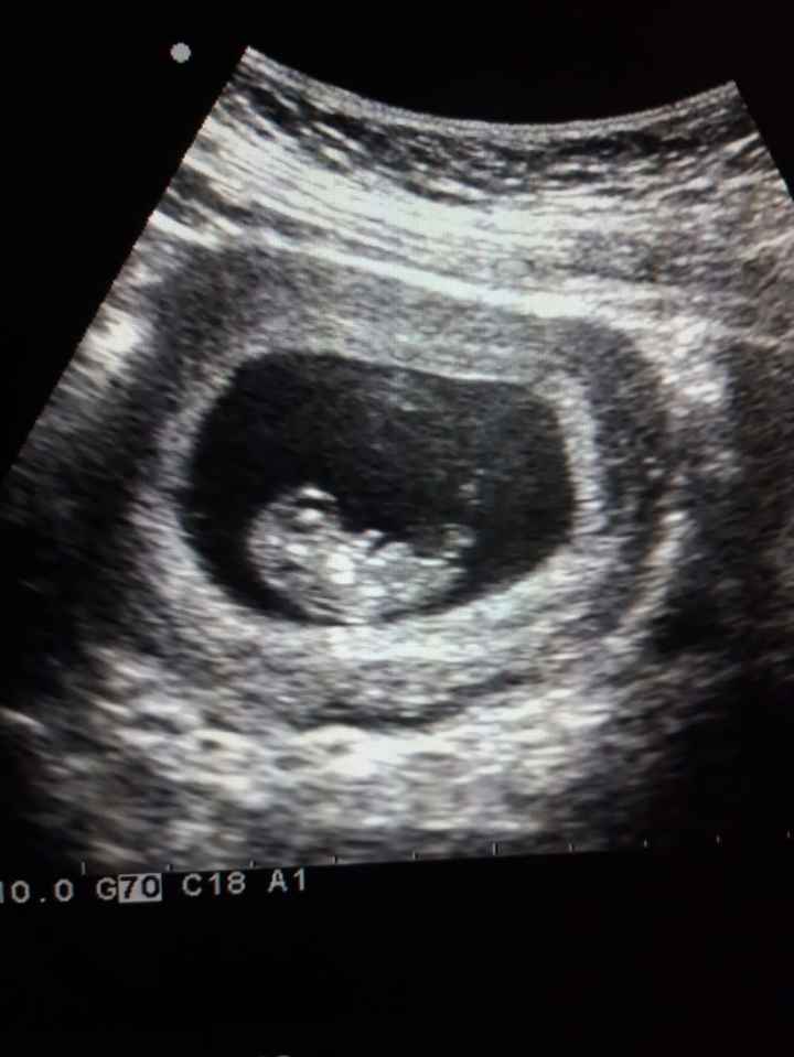 Futuras mamis Junio 2023 - 1