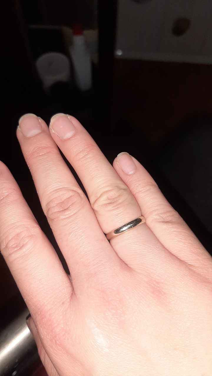 ¿Os parece normal lo de mi anillo? - 1