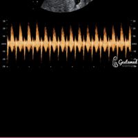 Futuras mamás Octubre 2022 🤰♥️ - 1