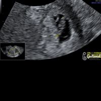 Futuras mamás Octubre 2022 🤰♥️ - 1