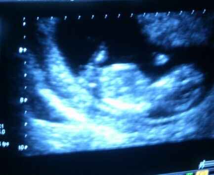El consultorio de Lita para futuras mamis - 1