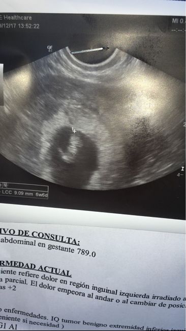 Ayuda con método ramzi: niño o niña? - 1