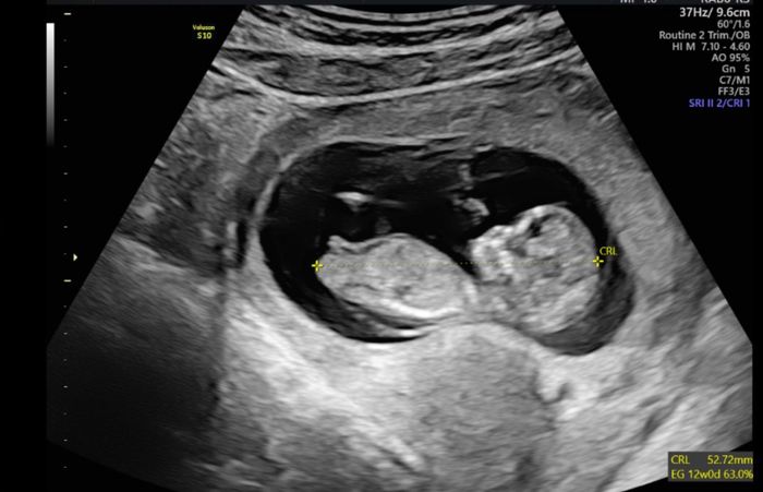 Futuras mamás Octubre 2022 🤰♥️ 1