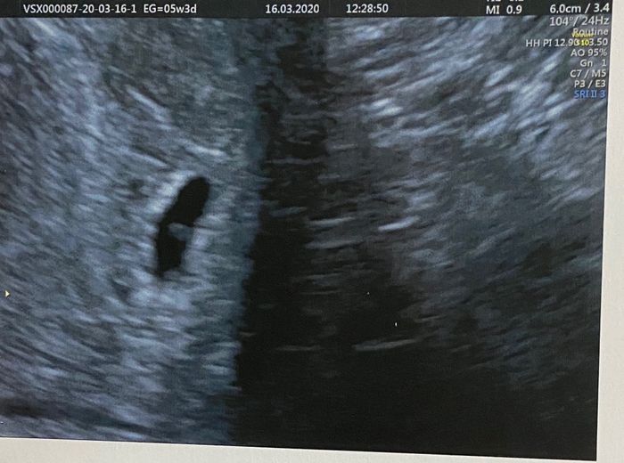 Futuras mamas noviembre 2020 - 1