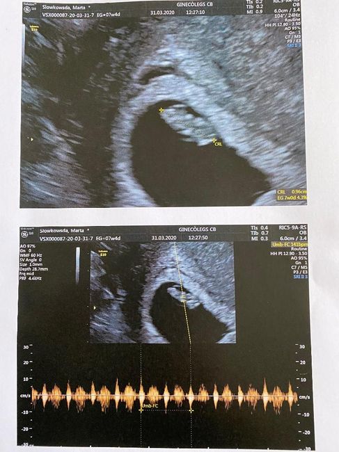 Futuras mamas noviembre 2020 - 1