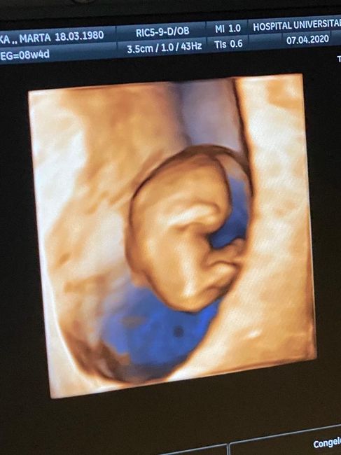 Futuras mamas noviembre 2020 - 1