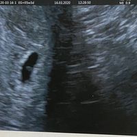 Futuras mamas noviembre 2020 - 1