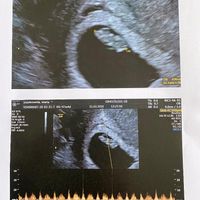 Futuras mamas noviembre 2020 - 1