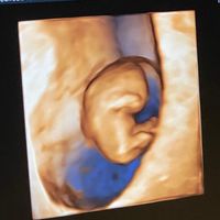 Futuras mamas noviembre 2020 - 1