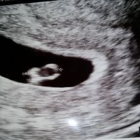 mi garbancito