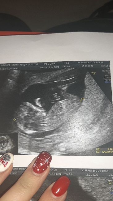 Futuras Mamas Julio 2020. - 1