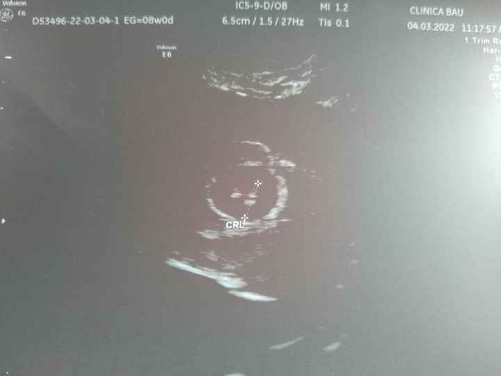 Futuras mamás Octubre 2022 🤰♥️ - 1