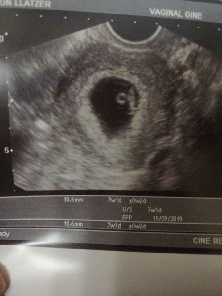 Futuras mamás septiembre 2019 - 1