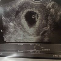 Futuras mamás septiembre 2019 - 1