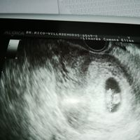 Ayuda con método ramzi: niño o niña? - 1