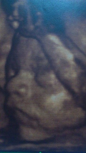 semana 26