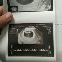 Mamis julio 2017 - 1