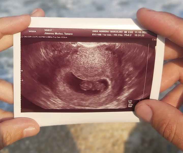 Ayuda con método ramzi: niño o niña? - 1