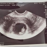 Ayuda con método ramzi: niño o niña? - 1