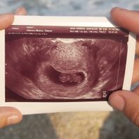 Ayuda con método ramzi: niño o niña? - 1