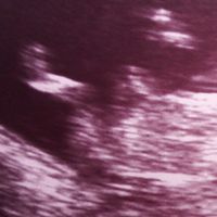 Ayuda con método ramzi: niño o niña? - 1