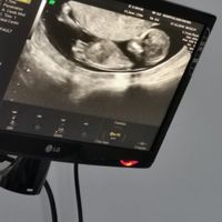Niño o niña - 1