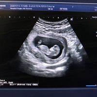 Ayuda con método ramzi: niño o niña? - 1