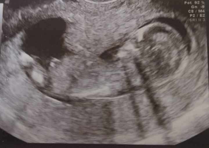 Futuras mamás octubre 2021 - 1
