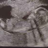 Futuras mamás octubre 2021 - 1