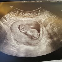 Futuras Mamis Abril 2021 - 1