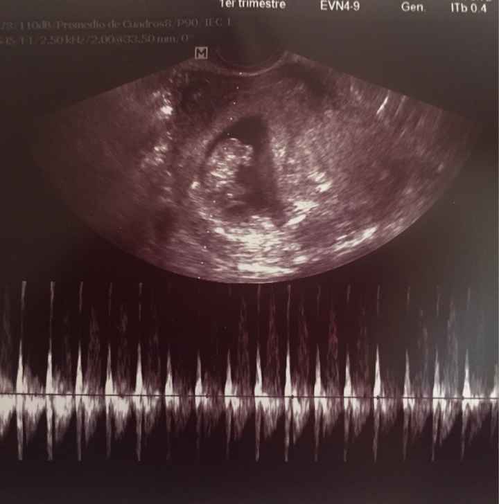 Futuras mamás Noviembre 2018! - 2