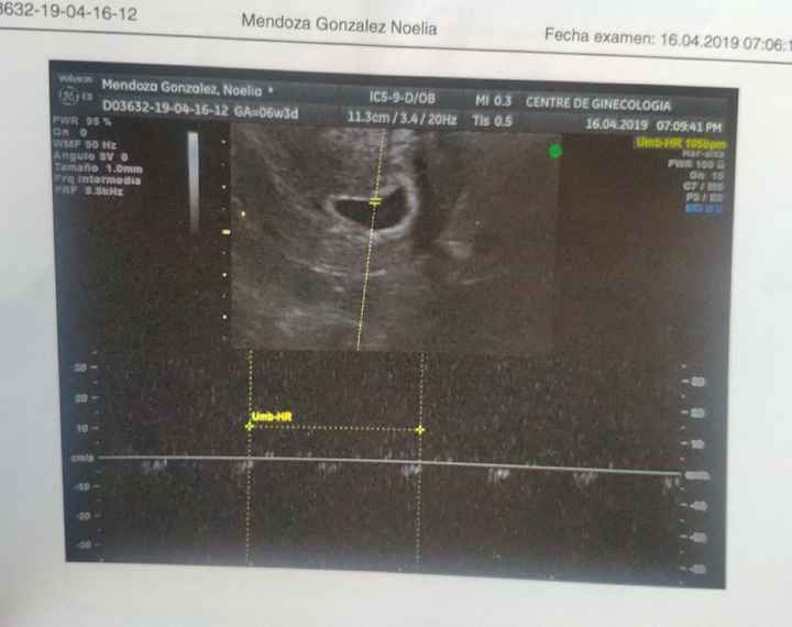 Ayuda con método ramzi: niño o niña? - 1