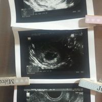 Mamis febrero 2016 - 1