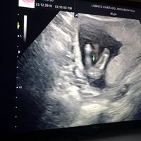 Futuras mamás Junio 2020 - 1