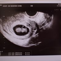 Eco vaginall 9 semanas