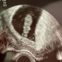 Futuras mamás octubre 2021 - 1