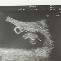 Mamis septiembre 2017 - 1