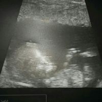 Mamis septiembre 2017 - 1