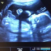 Futuras mamás Octubre 2018!!! - 1