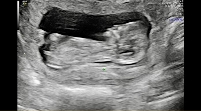 Futuras Mamis Noviembre - 1