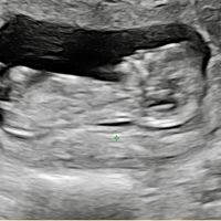 Futuras Mamis Noviembre - 1