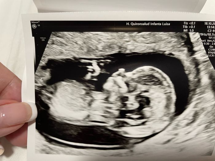 Futuras Mamis Abril 2022 🤰 5