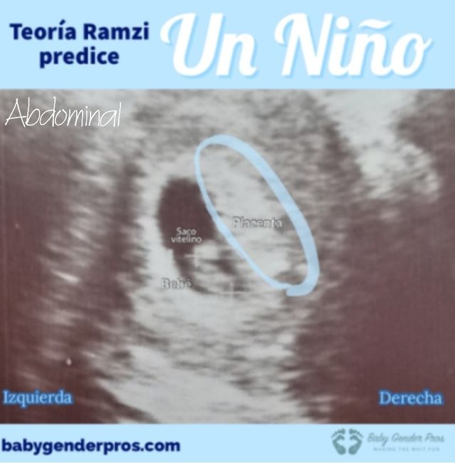 Ayuda con método ramzi: niño o niña? 7