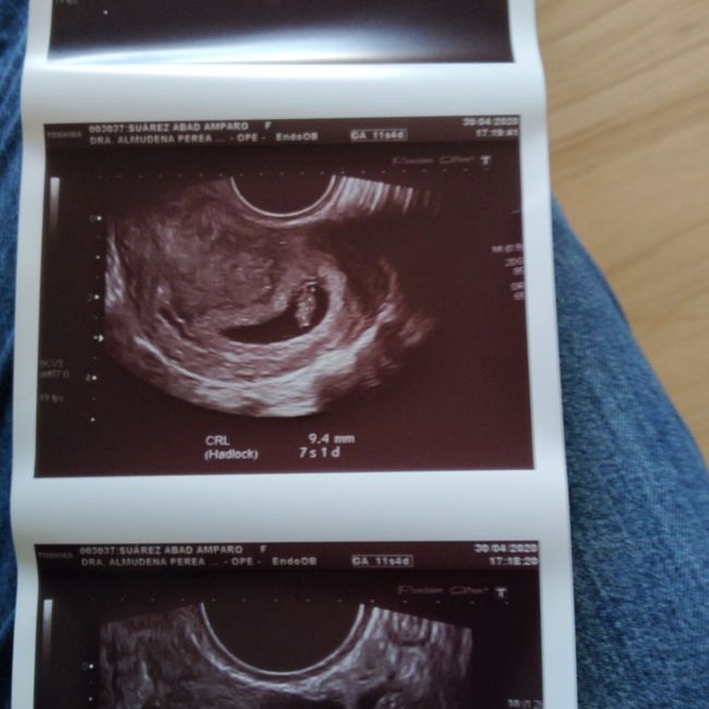 Futuras mamas Diciembre 2020 - 1