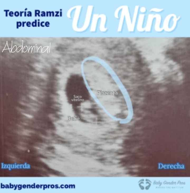 Ayuda con método ramzi: niño o niña? - 1