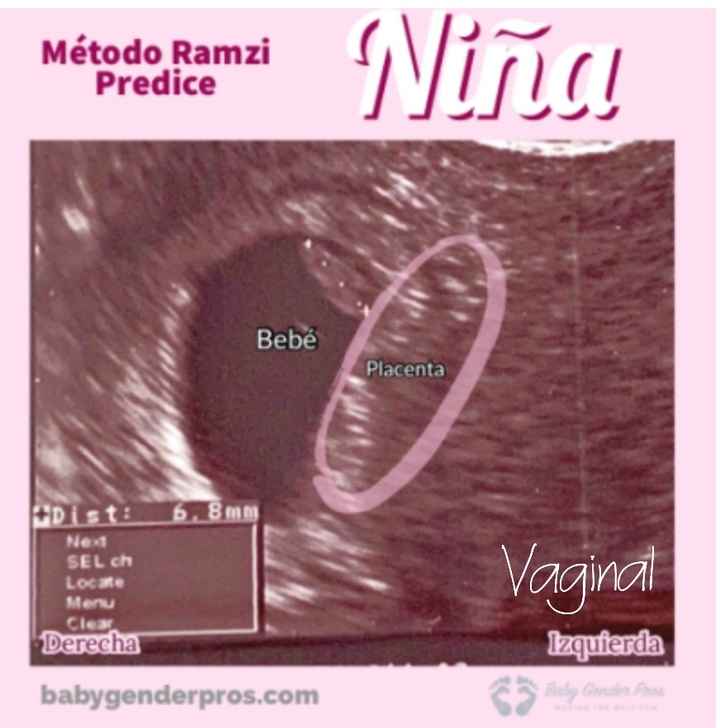Ayuda con método ramzi: niño o niña? - 2